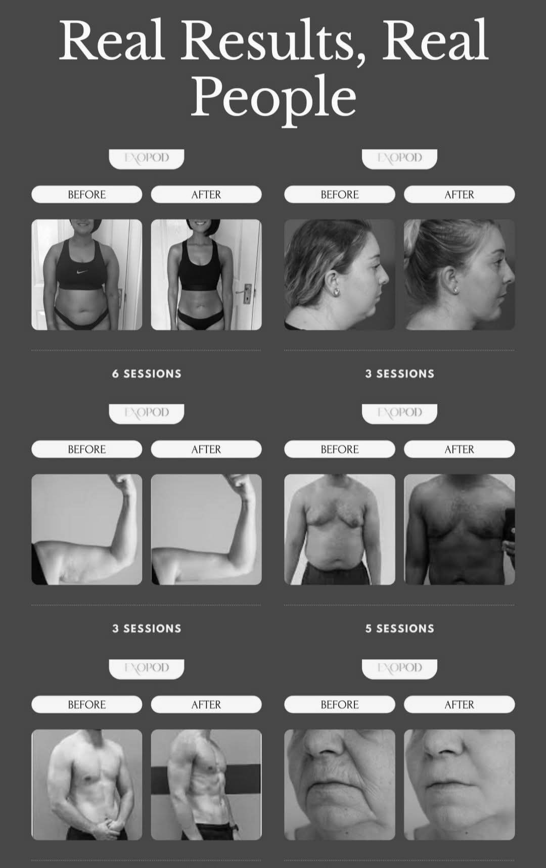 Before and after results from Hollywood Contouring members across multiple sessions
